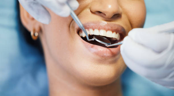 Best Emergency Treatment for Dental Infections or Abscesses in Southport, NC